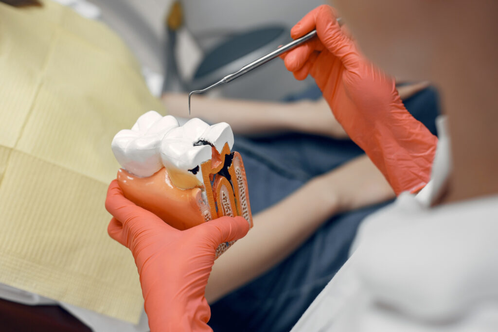 Can I Drive After a Root Canal? Here is My Personal Experience & Expert Medical Advice 2 root canal procedure